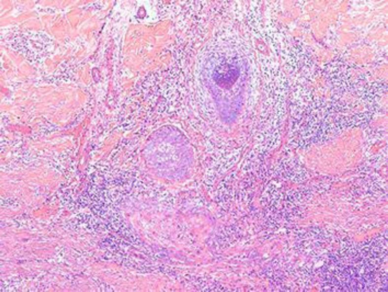 https://cdn.ncbi.nlm.nih.gov/pmc/blobs/4ad5/3884180/3d1bb24c0f8e/cde-0005-0272-g04.jpg