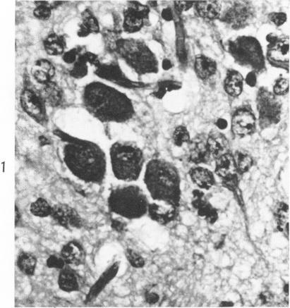https://cdn.ncbi.nlm.nih.gov/pmc/blobs/4ad7/1920428/043e922e33f9/amjpathol00285-0062-a.jpg