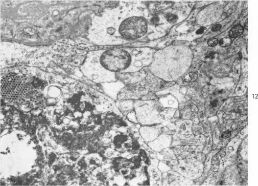 https://cdn.ncbi.nlm.nih.gov/pmc/blobs/4ad7/1920428/1599214f70f9/amjpathol00285-0070-b.jpg