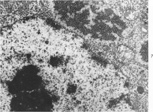 https://cdn.ncbi.nlm.nih.gov/pmc/blobs/4ad7/1920428/e67ba5e14edb/amjpathol00285-0066-a.jpg