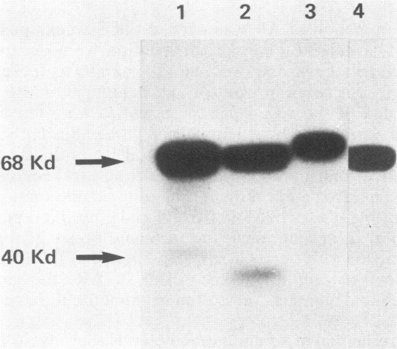 https://cdn.ncbi.nlm.nih.gov/pmc/blobs/4ada/261377/108804575bd0/iai00120-0174-a.jpg