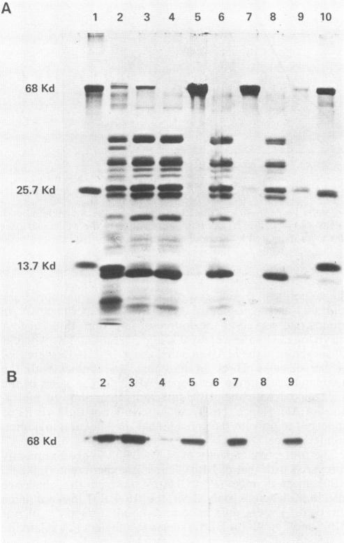 https://cdn.ncbi.nlm.nih.gov/pmc/blobs/4ada/261377/7f26814447c1/iai00120-0176-a.jpg