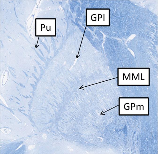 https://cdn.ncbi.nlm.nih.gov/pmc/blobs/4ae0/5743521/3f165996f29e/mrms-16-304-g1.jpg