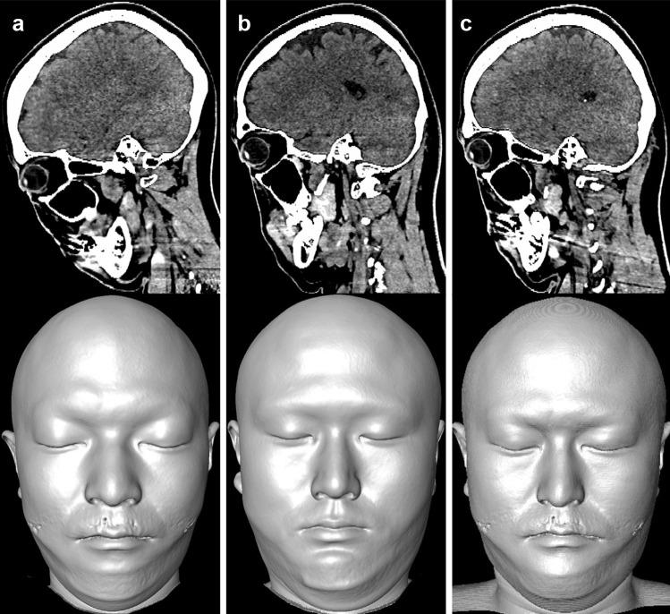 https://cdn.ncbi.nlm.nih.gov/pmc/blobs/4ae7/10406725/b220aa4d2a61/12021_2023_9631_Fig6_HTML.jpg