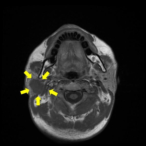 https://cdn.ncbi.nlm.nih.gov/pmc/blobs/4aee/6525968/1b0fc68a1470/13000_2019_825_Fig1_HTML.jpg