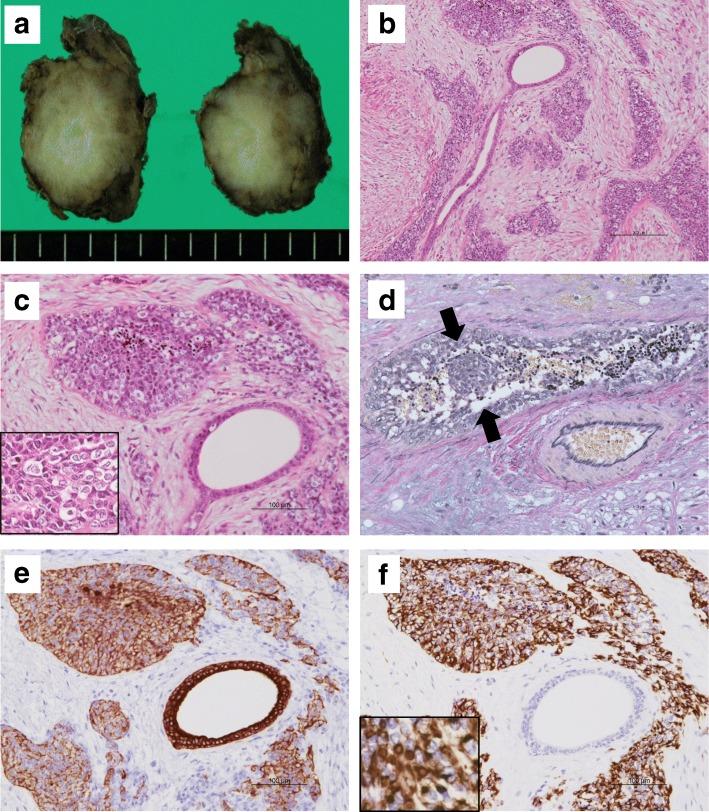https://cdn.ncbi.nlm.nih.gov/pmc/blobs/4aee/6525968/5d61735f7d10/13000_2019_825_Fig2_HTML.jpg
