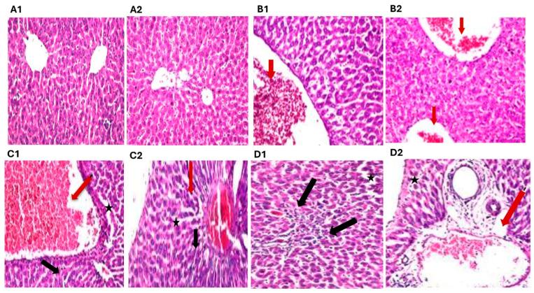 https://cdn.ncbi.nlm.nih.gov/pmc/blobs/4af6/12299754/6bbeddb66a24/toxics-13-00594-g002.jpg