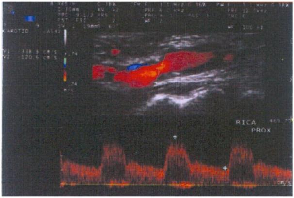 https://cdn.ncbi.nlm.nih.gov/pmc/blobs/4af8/5692133/c814eb1bb8ef/10.1177_2050313X17741826-fig2.jpg