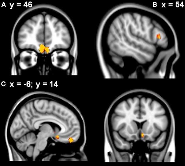 https://cdn.ncbi.nlm.nih.gov/pmc/blobs/4afa/3859902/22bb0c86d230/fncom-07-00180-g0002.jpg