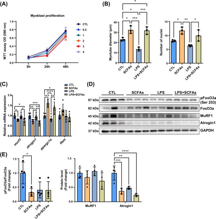 https://cdn.ncbi.nlm.nih.gov/pmc/blobs/4b11/11634463/61cee1a4c28e/JCSM-15-2387-g004.jpg