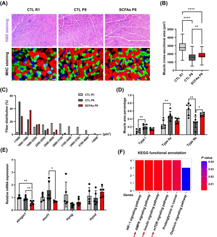 https://cdn.ncbi.nlm.nih.gov/pmc/blobs/4b11/11634463/b0c272bd3e75/JCSM-15-2387-g002.jpg