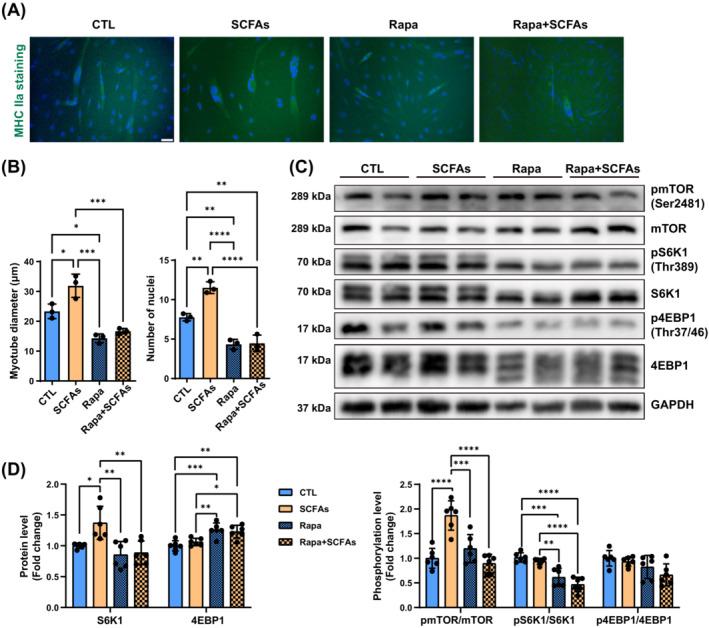 https://cdn.ncbi.nlm.nih.gov/pmc/blobs/4b11/11634463/b9ccc68a3a57/JCSM-15-2387-g005.jpg