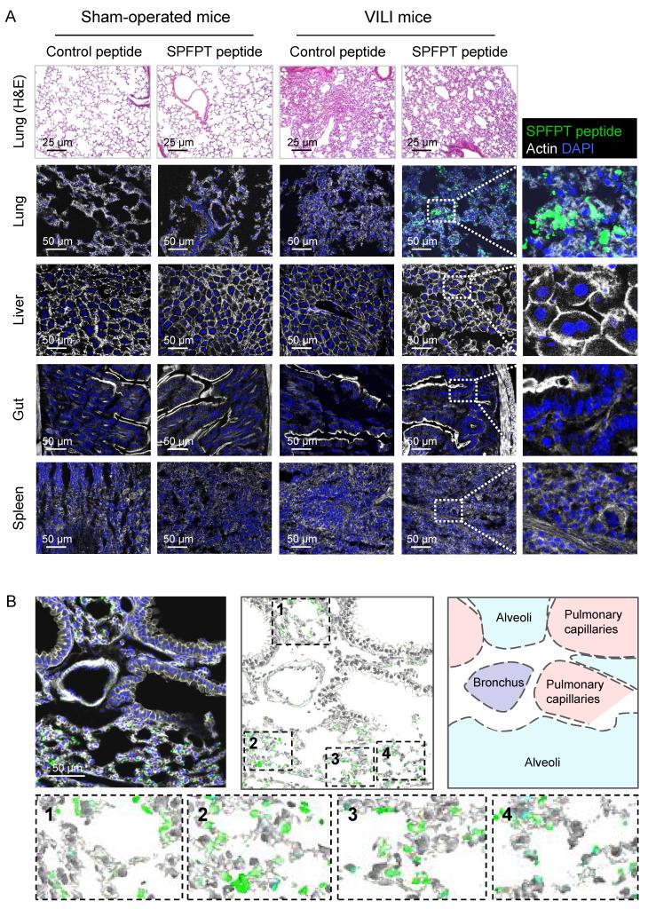 https://cdn.ncbi.nlm.nih.gov/pmc/blobs/4b11/12160035/71f36eea4e77/thnov15p6534g003.jpg