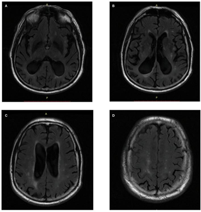 https://cdn.ncbi.nlm.nih.gov/pmc/blobs/4b1a/9237397/041b8f5cfa75/fnhum-16-760360-g0002.jpg