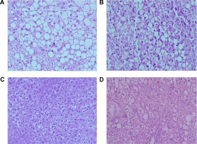 https://cdn.ncbi.nlm.nih.gov/pmc/blobs/4b23/4531046/b2785d3adb4b/ijn-10-5049Fig4.jpg