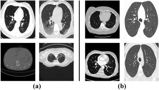 https://cdn.ncbi.nlm.nih.gov/pmc/blobs/4b2b/7924021/ee623c97704d/12652_2021_2967_Fig3_HTML.jpg
