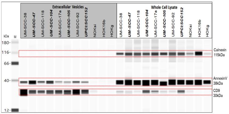 https://cdn.ncbi.nlm.nih.gov/pmc/blobs/4b2b/8345072/64200134560e/cancers-13-03714-g003.jpg