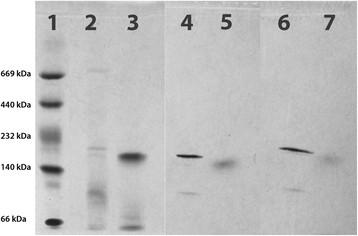 https://cdn.ncbi.nlm.nih.gov/pmc/blobs/4b2c/4052635/821b416be396/s13568-014-0030-2-2.jpg