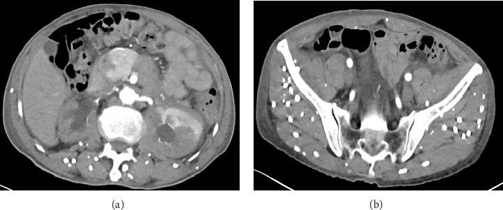 https://cdn.ncbi.nlm.nih.gov/pmc/blobs/4b2d/12145928/d12663a71788/CRIID2025-6221398.001.jpg
