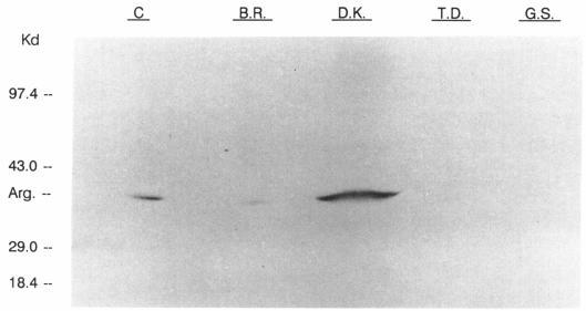 https://cdn.ncbi.nlm.nih.gov/pmc/blobs/4b31/1682550/d37f10a97d6d/ajhg00077-0139-a.jpg