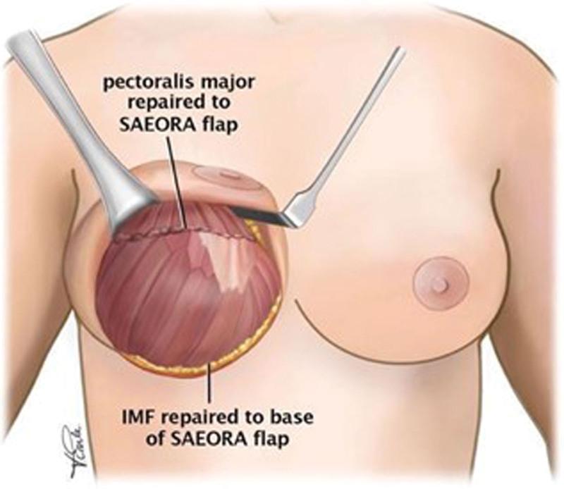 https://cdn.ncbi.nlm.nih.gov/pmc/blobs/4b35/11191962/96124f13b093/gox-12-e5852-g004.jpg
