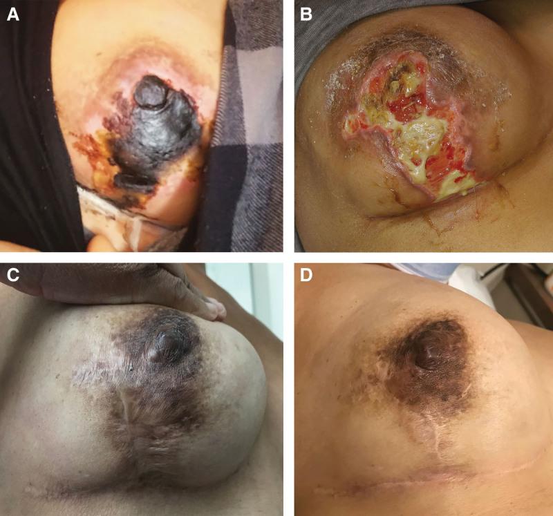 https://cdn.ncbi.nlm.nih.gov/pmc/blobs/4b35/11191962/b3c3923f94b8/gox-12-e5852-g009.jpg
