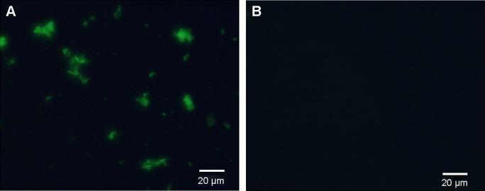 https://cdn.ncbi.nlm.nih.gov/pmc/blobs/4b39/4386779/fe69d5c5491b/ijn-10-2507Fig2.jpg