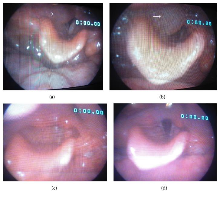 https://cdn.ncbi.nlm.nih.gov/pmc/blobs/4b3a/4835642/1378916c4e0e/CRIOT2016-2175856.001.jpg