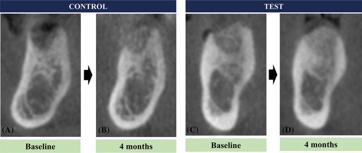 https://cdn.ncbi.nlm.nih.gov/pmc/blobs/4b43/6587521/b89d5685830b/CID-21-175-g004.jpg