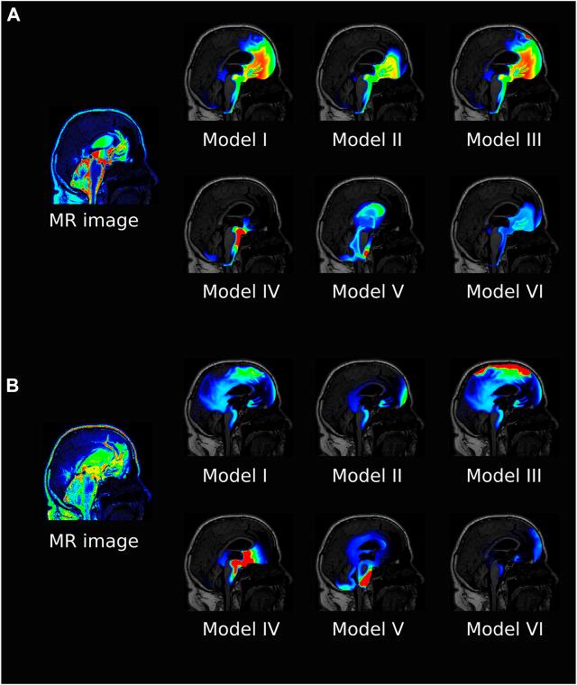 https://cdn.ncbi.nlm.nih.gov/pmc/blobs/4b45/9510842/39c2d99650b1/fbioe-10-932469-g004.jpg