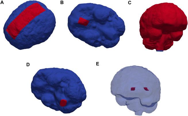 https://cdn.ncbi.nlm.nih.gov/pmc/blobs/4b45/9510842/66f71e287c58/fbioe-10-932469-g002.jpg