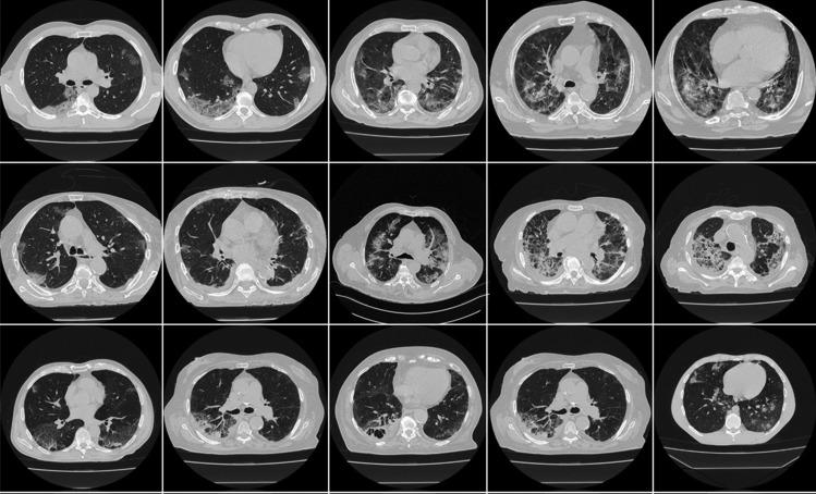 https://cdn.ncbi.nlm.nih.gov/pmc/blobs/4b46/9392994/6ec771f8d7b5/10916_2022_1850_Fig2_HTML.jpg