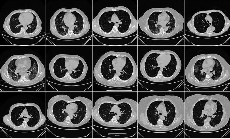 https://cdn.ncbi.nlm.nih.gov/pmc/blobs/4b46/9392994/b25df45e35ec/10916_2022_1850_Fig3_HTML.jpg