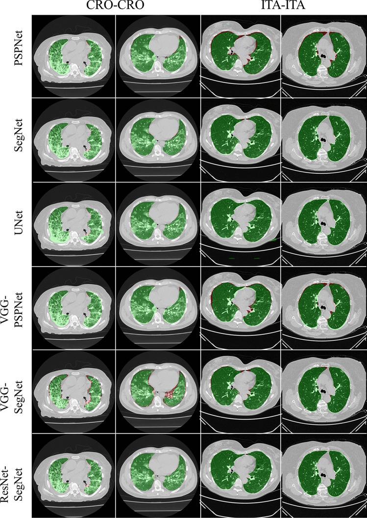 https://cdn.ncbi.nlm.nih.gov/pmc/blobs/4b46/9392994/b631b120a216/10916_2022_1850_Fig11_HTML.jpg