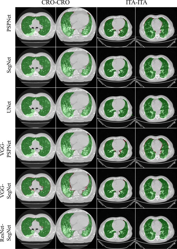 https://cdn.ncbi.nlm.nih.gov/pmc/blobs/4b46/9392994/d0a42eb7290b/10916_2022_1850_Fig10_HTML.jpg