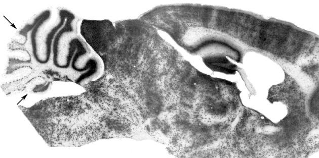 https://cdn.ncbi.nlm.nih.gov/pmc/blobs/4b47/3551280/582ea515c8c7/fncir-06-00123-g0003.jpg
