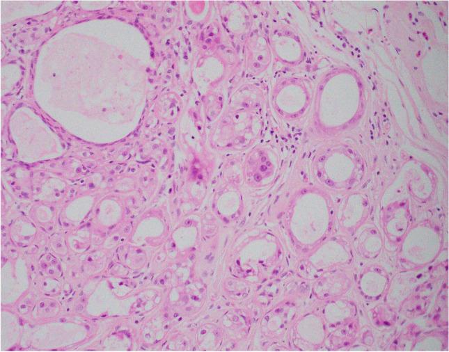 https://cdn.ncbi.nlm.nih.gov/pmc/blobs/4b4e/8983539/1541ad3a631d/428_2021_3185_Fig4_HTML.jpg