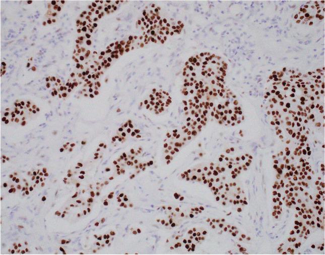 https://cdn.ncbi.nlm.nih.gov/pmc/blobs/4b4e/8983539/8efa14b023ad/428_2021_3185_Fig13_HTML.jpg