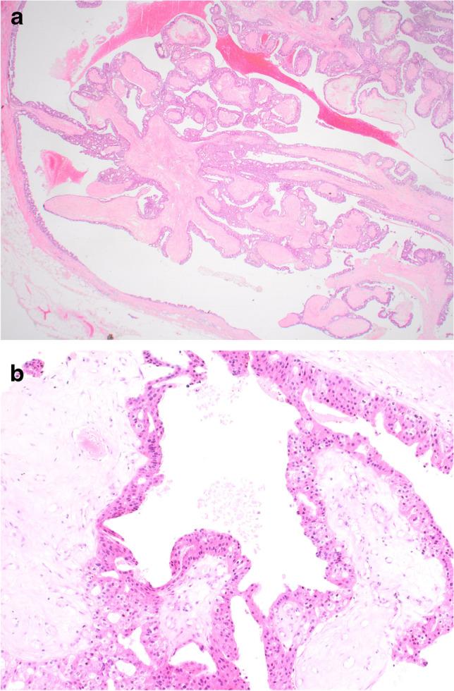 https://cdn.ncbi.nlm.nih.gov/pmc/blobs/4b4e/8983539/cc2347a99630/428_2021_3185_Fig9_HTML.jpg