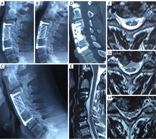 https://cdn.ncbi.nlm.nih.gov/pmc/blobs/4b65/11151240/6f83559d7861/qims-14-06-3923-f4.jpg