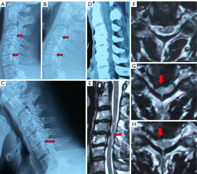 https://cdn.ncbi.nlm.nih.gov/pmc/blobs/4b65/11151240/90078079aca1/qims-14-06-3923-f3.jpg