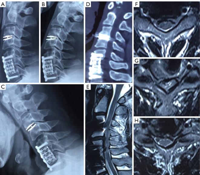 https://cdn.ncbi.nlm.nih.gov/pmc/blobs/4b65/11151240/db215c296152/qims-14-06-3923-f2.jpg