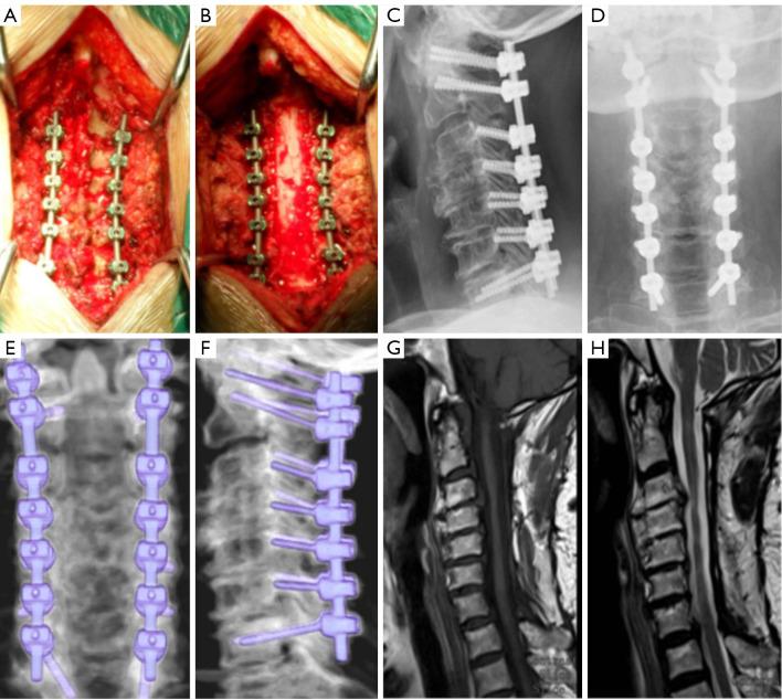 https://cdn.ncbi.nlm.nih.gov/pmc/blobs/4b65/11151240/efdc9751aeec/qims-14-06-3923-f6.jpg