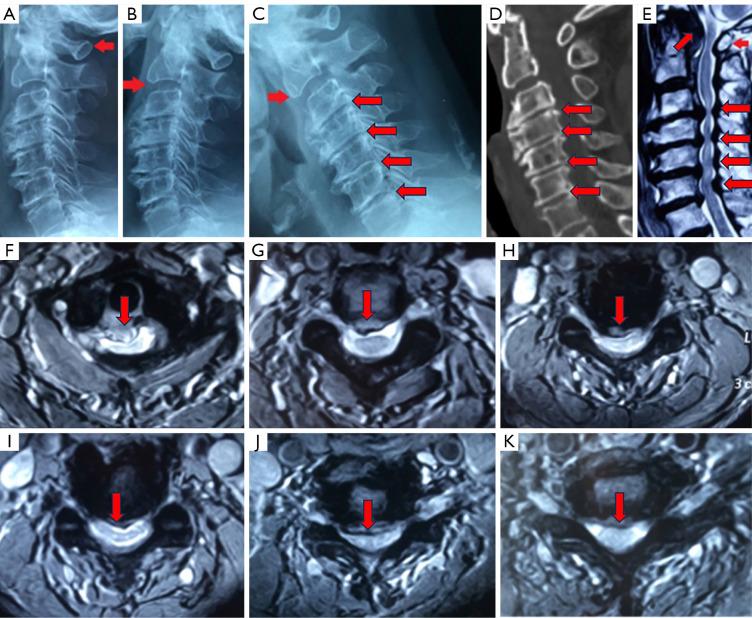 https://cdn.ncbi.nlm.nih.gov/pmc/blobs/4b65/11151240/f55137528b8b/qims-14-06-3923-f5.jpg