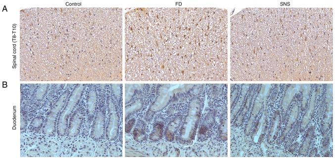 https://cdn.ncbi.nlm.nih.gov/pmc/blobs/4b65/6889936/17beb7f4c12d/IJMM-45-01-0053-g01.jpg