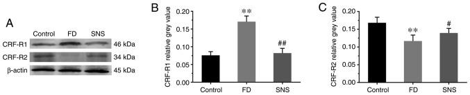 https://cdn.ncbi.nlm.nih.gov/pmc/blobs/4b65/6889936/36a7b02a468b/IJMM-45-01-0053-g02.jpg