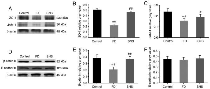 https://cdn.ncbi.nlm.nih.gov/pmc/blobs/4b65/6889936/5331f6ae68dd/IJMM-45-01-0053-g05.jpg