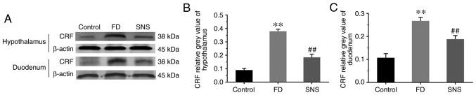 https://cdn.ncbi.nlm.nih.gov/pmc/blobs/4b65/6889936/9b38cc355305/IJMM-45-01-0053-g00.jpg