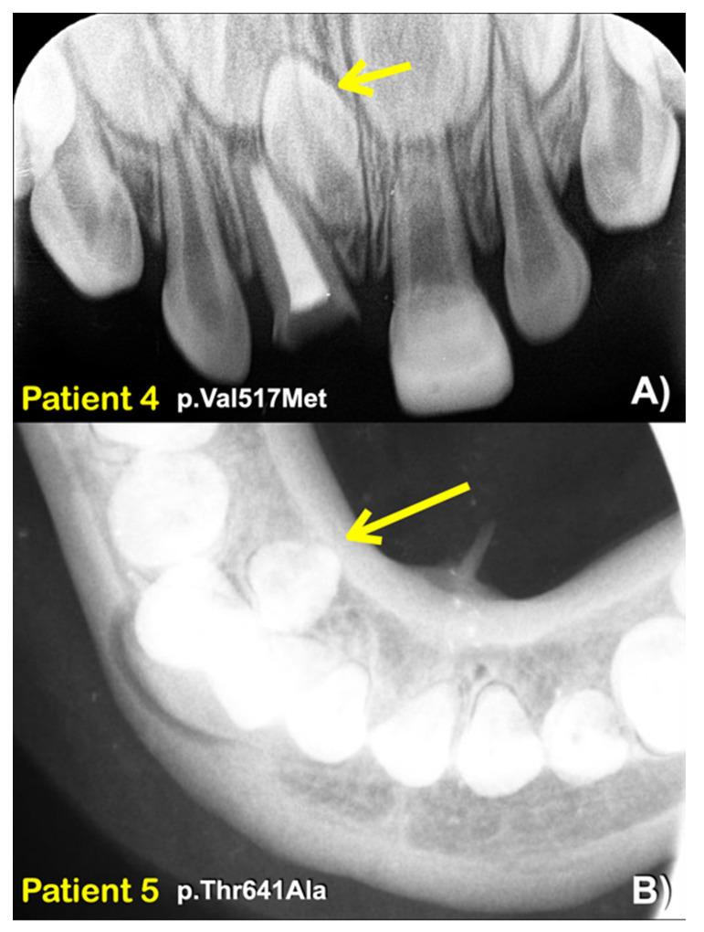 https://cdn.ncbi.nlm.nih.gov/pmc/blobs/4b67/10093539/276cf3419a0d/diagnostics-13-01214-g003.jpg