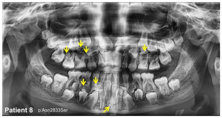 https://cdn.ncbi.nlm.nih.gov/pmc/blobs/4b67/10093539/590561bb2cd2/diagnostics-13-01214-g006.jpg
